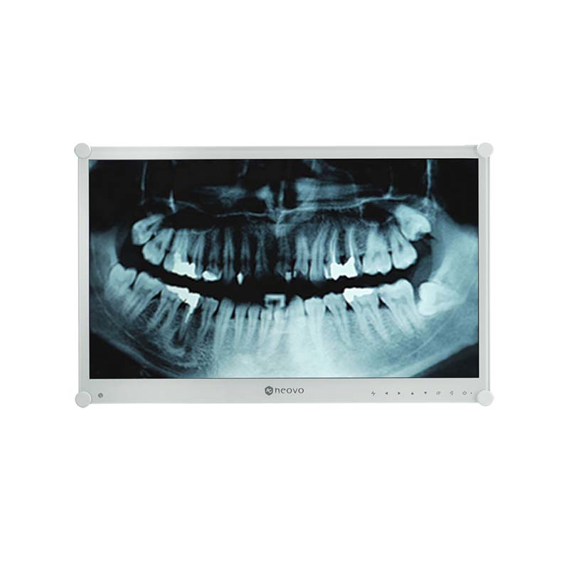 Neovo 24" DR-24G Orvosi monitor - 1920x1080, VA, 75 Hz, Fehér